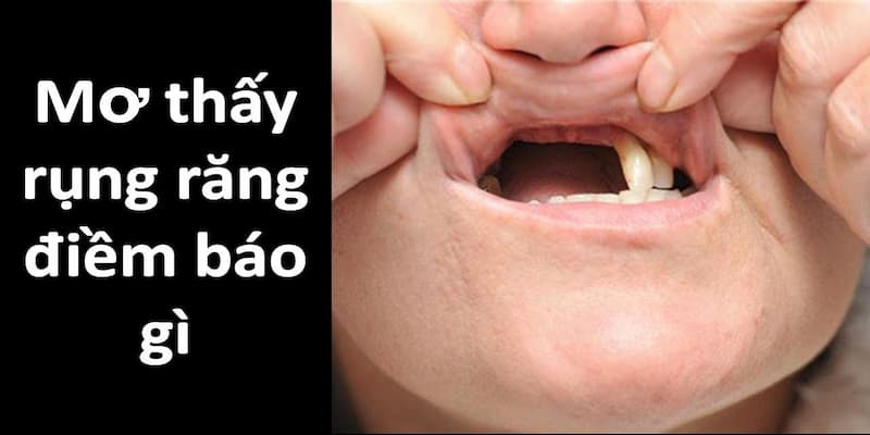 Giải mã giấc mơ thấy rụng răng và những điềm báo ẩn chứa