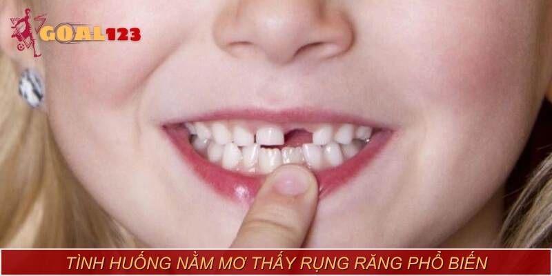 Giải mã từng trường hợp cụ thể khi nằm mơ thấy rụng răng