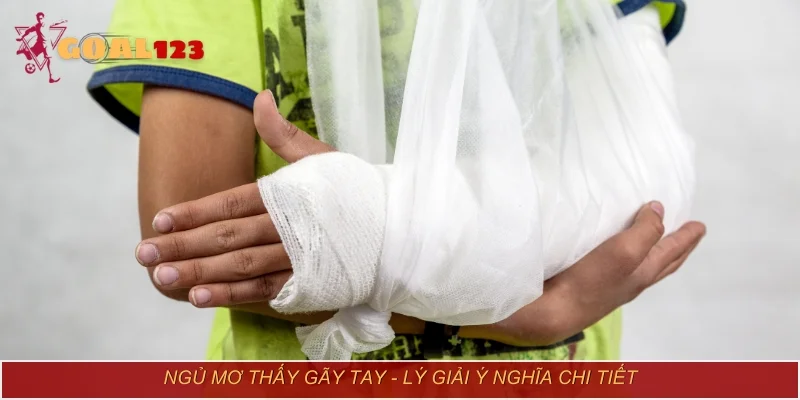 Ngủ mơ thấy gãy tay - Lý giải ý nghĩa chi tiết