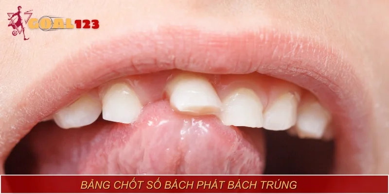 Bảng chốt số bách phát bách trúng khi mơ rụng răng